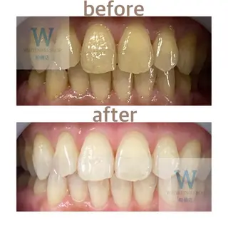 ホワイトニング ショップ船橋2号店のエステ・リラクイメージ