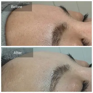 トータルしみケア専門 NICA(ニカ)のエステ・リラクイメージ