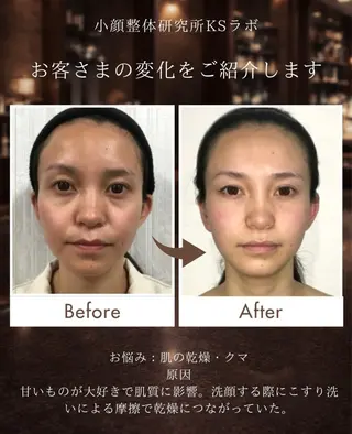 KSラボ自由が丘店所属・小顔整体研究所 KSラボ自由が丘店のエステ・リラクイメージ