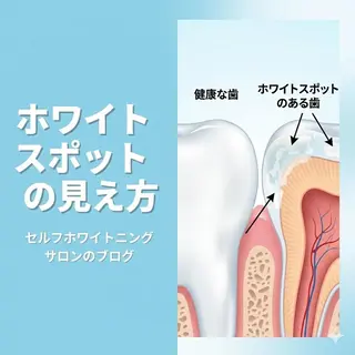 アイブロウ ホワイトニングサロン nico西葛西店のその他イメージ