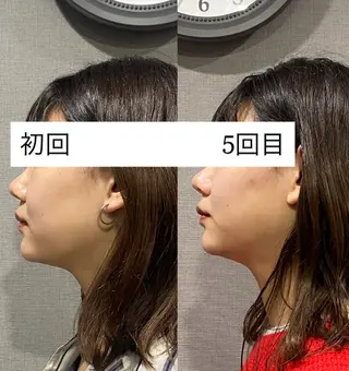 肌質改善専門 ハーブ /毛穴洗浄 リエイトのエステ・リラクイメージ