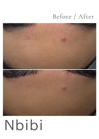 韓国🇰🇷価格 サロン_Nbibiのエステ・リラクイメージ