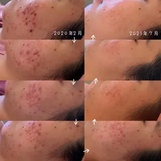 美肌蘇生カウンセラー 横山りえのエステ・リラクイメージ