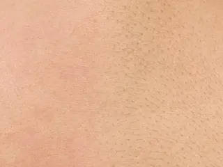 Hit. シュガーリング豊橋のエステ・リラクイメージ