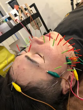 美容鍼灸整体サロンBeauJu所属・小顔矯/美容鍼/鍼灸 BeauJuのその他イメージ