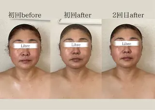 小顔コルギ&肌質改善 の専門店LIBREのエステ・リラクイメージ