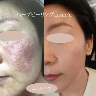 美腸サロン🌺 腸もみ/小顔/リンパのエステ・リラクイメージ