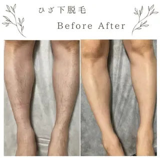 メンズ な ぎのエステ・リラクイメージ