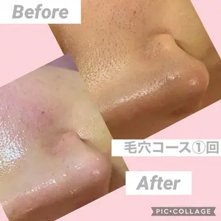 COCOPURE. 凪..のエステ・リラクイメージ