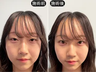 渋谷 小顔美容鍼 専門サロン YZのエステ・リラクイメージ