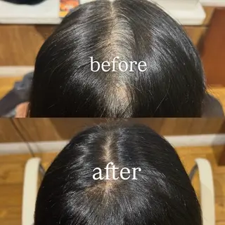 カラー 根本 琴子のヘアスタイル