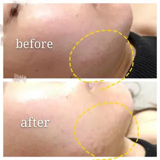 🅖🅤🅩🅔🅛 salonのエステ・リラクイメージ