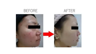 肌質改善専門サロン ／FSS渋谷店　松本のエステ・リラクイメージ