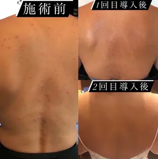 private salon arのマツエク・マツパデザイン