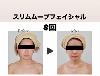 エルモサ痩身脱毛　西八王子店所属・エルモサ痩身脱毛 西八王子店のエステ・リラクイメージ