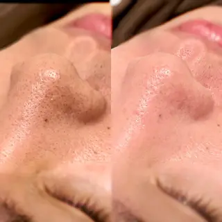 眉毛×肌質改善🫧 高岳/新栄町✨YUUの眉毛・アイブロウイメージ