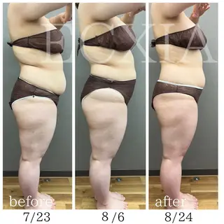 ECXIA 【エクシア】のエステ・リラクイメージ