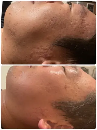 ロミロミ ・艶肌小顔 RIEのエステ・リラクイメージ