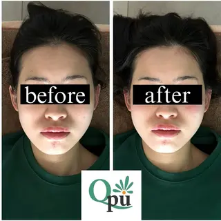 Qpu(キュープ)下北沢店所属・鮎川 さゆりのエステ・リラクイメージ