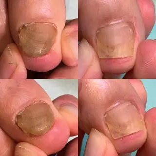 ネイル 東京巻き爪アカデミー所属・東京巻き爪 アカデミーのエステ・リラクイメージ