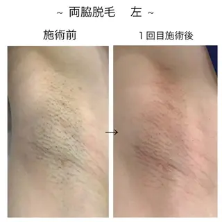 ビューティー ミロワールのエステ・リラクイメージ