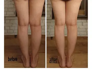 美容矯正 ＱＵＩＣＯ【キコ】のその他イメージ