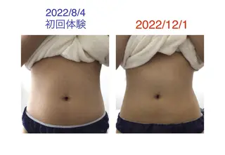 子宮矯正/腸揉み/ シュガーリング脱毛のエステ・リラクイメージ