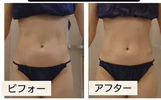 M✨ Hoshi💎✨のエステ・リラクイメージ