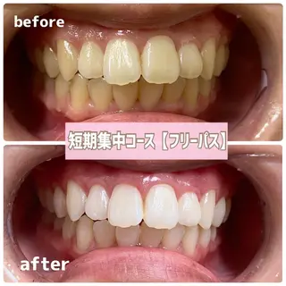 ホワイトニングサロン BE WHITE金山のその他イメージ