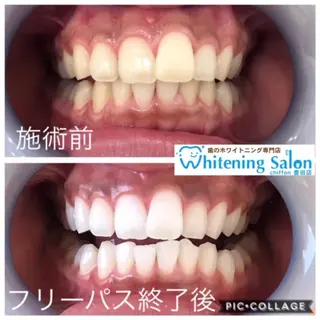 歯科レベルの白さ💎 ✨ホワイトニング豊田のエステ・リラクイメージ