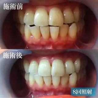 LBSホワイトニング上野店所属・LBSホワイトニング 🌐 上野店公式のエステ・リラクイメージ