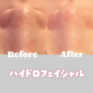 アイラッシュ&エステサロンLinda西宮所属・小顔&毛穴・肌質改善 LINDA西宮 AIのエステ・リラクイメージ