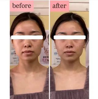 MIRAI小顔 岡山店のエステ・リラクイメージ