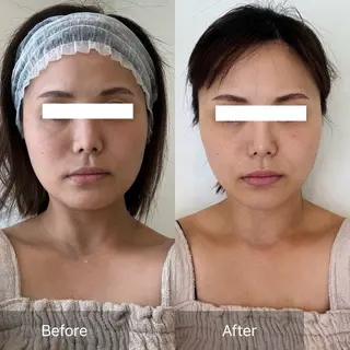 Charis エステ&ネイルのエステ・リラクイメージ