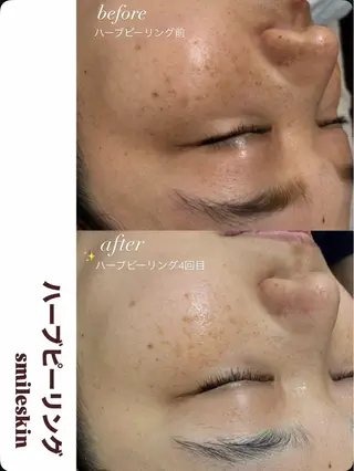 smileskin 御薗橋／meguのその他イメージ