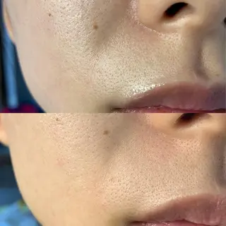 メンズ キッズ 脱毛SALON RaYNiCKのエステ・リラクイメージ