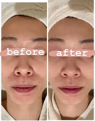 POLA THE BEAUTY 堺東店所属・肌管理🌿毛穴改善 POLA堺東のエステ・リラクイメージ