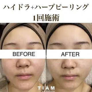 美肌サロンTIAM by tetoteのエステ・リラクイメージ