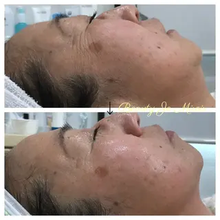 ビューティー ミロワールのエステ・リラクイメージ