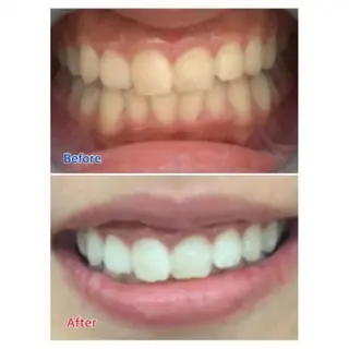 M渋谷店所属・Ｍ渋谷 ホワイトニングのエステ・リラクイメージ