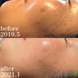 浜野 恵美のエステ・リラクイメージ