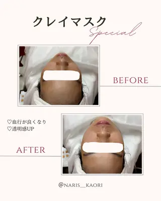 フェイシャルエステ♡ KAORIのエステ・リラクイメージ