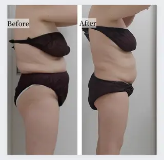 ユニセックスエステサロンUniclear所属・痩身&フェイシャル Uniclearのエステ・リラクイメージ