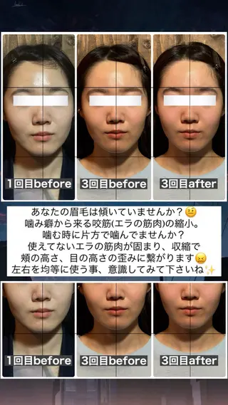💎後悔させない小顔 矯正💎イトヤマ🌱のエステ・リラクイメージ