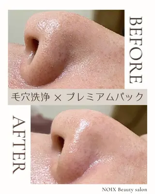 NOIXbeauty salonのエステ・リラクイメージ