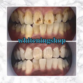 ホワイトニングショップ津店所属・ホワイトニング ショップ津店のその他イメージ