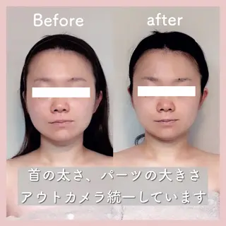 小顔矯正専門店Gémiey所属・越谷駅徒歩３分 小顔専門Gemieyのエステ・リラクイメージ