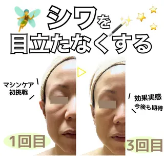 stella所属・stella都度払い 痩身小顔まつげパーマのマツエク・マツパデザイン