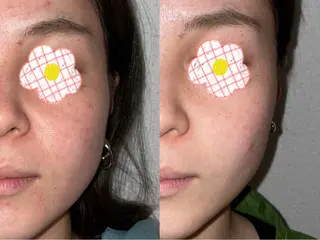 ☆専門店にお任せ☆ ホワイトニング吉祥寺のその他イメージ