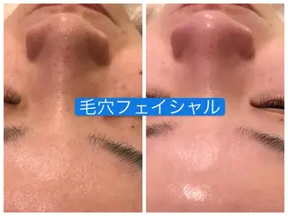 毛穴洗浄& 睫毛パーマ上野御徒町のマツエク・マツパデザイン